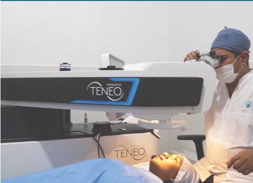 Equipo de Cirugía Excimer Láser TENEO